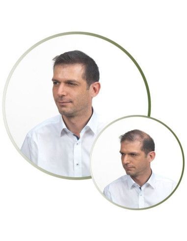 Fibras Capilares