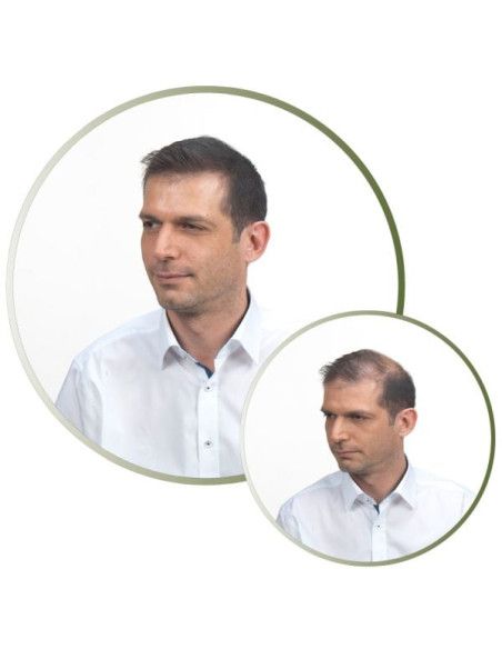Fibras Capilares